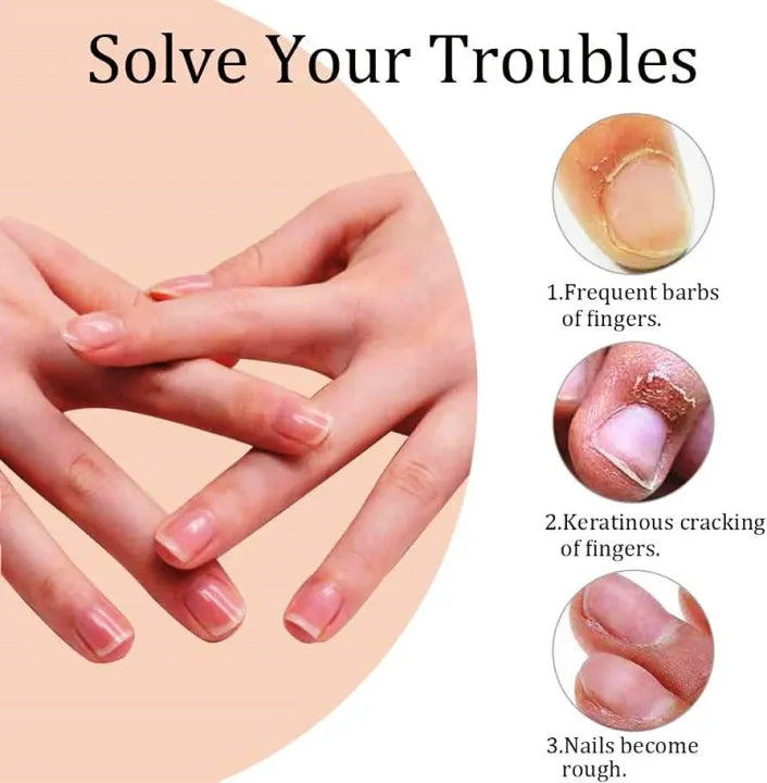 Nail Oil Pen (Cuticle's Oil)