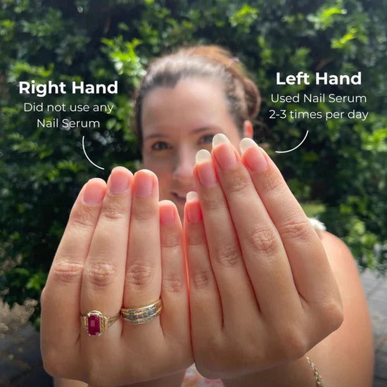 Nail Oil Pen (Cuticle's Oil)