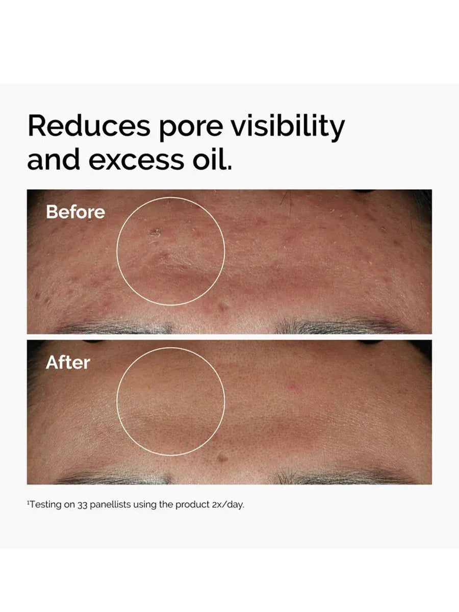 The Ordinary Niacinamide 10%+ Zinc 1% Serum 30ml